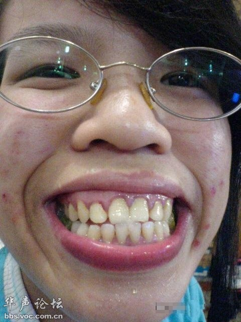 中国网络丑女排行榜,凤姐居然未进前五!心脏不好慎入